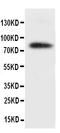 DCC-interacting protein 13-alpha antibody, PA1389, Boster Biological Technology, Western Blot image 