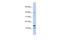 WAP Four-Disulfide Core Domain 5 antibody, A15141, Boster Biological Technology, Western Blot image 