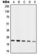 Ribosomal Protein L10 antibody, LS-C352786, Lifespan Biosciences, Western Blot image 