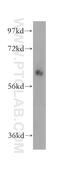 OMA1 Zinc Metallopeptidase antibody, 17116-1-AP, Proteintech Group, Western Blot image 