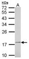 NADH:Ubiquinone Oxidoreductase Subunit AB1 antibody, NBP2-19502, Novus Biologicals, Western Blot image 