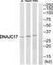 DnaJ Heat Shock Protein Family (Hsp40) Member C17 antibody, TA315573, Origene, Western Blot image 