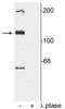 TAO Kinase 2 antibody, P07466, Boster Biological Technology, Western Blot image 