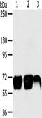 Matrix metalloproteinase-9 antibody, TA351481, Origene, Western Blot image 