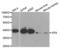 XPA, DNA Damage Recognition And Repair Factor antibody, abx001370, Abbexa, Western Blot image 