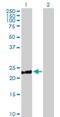 Dephospho-CoA Kinase Domain Containing antibody, H00079877-B01P, Novus Biologicals, Western Blot image 