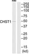 Carbohydrate sulfotransferase 1 antibody, PA5-39073, Invitrogen Antibodies, Western Blot image 