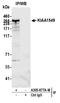 KIAA1549 antibody, A305-877A-M, Bethyl Labs, Immunoprecipitation image 