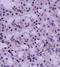 Hepatocyte Growth Factor antibody, orb10794, Biorbyt, Immunohistochemistry paraffin image 