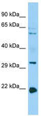 Coronin 1B antibody, TA331827, Origene, Western Blot image 