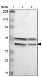 G patch domain and ankyrin repeats-containing protein 1 antibody, PA5-52275, Invitrogen Antibodies, Western Blot image 