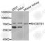 Rho-related BTB domain-containing protein 1 antibody, A9959, ABclonal Technology, Western Blot image 