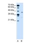 G Protein-Coupled Receptor 161 antibody, NBP1-60122, Novus Biologicals, Western Blot image 