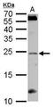 Regulator of G-protein signaling 4 antibody, TA308780, Origene, Western Blot image 