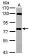 Myotubularin Related Protein 14 antibody, PA5-30801, Invitrogen Antibodies, Western Blot image 