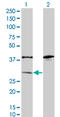 Sulfotransferase 1A1 antibody, LS-C198285, Lifespan Biosciences, Western Blot image 