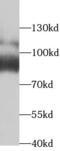 Threonyl-TRNA Synthetase antibody, FNab08501, FineTest, Western Blot image 