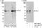 P21 (RAC1) Activated Kinase 1 antibody, A301-259A, Bethyl Labs, Immunoprecipitation image 
