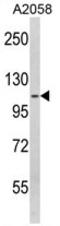 SPINK5 antibody, AP17762PU-N, Origene, Western Blot image 