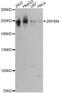 Zinc Finger MYM-Type Containing 4 antibody, LS-C748835, Lifespan Biosciences, Western Blot image 
