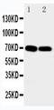 Potassium Voltage-Gated Channel Subfamily A Member 6 antibody, PA2271, Boster Biological Technology, Western Blot image 