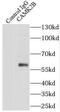 Calcium/Calmodulin Dependent Protein Kinase II Beta antibody, FNab01230, FineTest, Immunoprecipitation image 