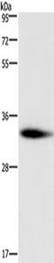 2-Aminoethanethiol Dioxygenase antibody, TA322127, Origene, Western Blot image 