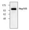 HSPH1 antibody, AP00139PU-N, Origene, Western Blot image 