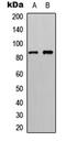 Ribosomal protein S6 kinase alpha-6 antibody, GTX55279, GeneTex, Western Blot image 