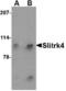 SLIT And NTRK Like Family Member 4 antibody, TA306528, Origene, Western Blot image 