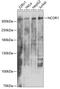 Nuclear receptor corepressor 1 antibody, 22-657, ProSci, Western Blot image 