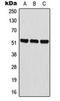 BAI1 Associated Protein 2 Like 2 antibody, orb224126, Biorbyt, Western Blot image 