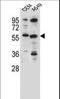 Cysteine Sulfinic Acid Decarboxylase antibody, LS-C167074, Lifespan Biosciences, Western Blot image 