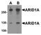 AT-Rich Interaction Domain 1A antibody, A00247, Boster Biological Technology, Western Blot image 