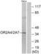 Olfactory Receptor Family 2 Subfamily A Member 7 antibody, abx015409, Abbexa, Western Blot image 