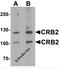 Crumbs Cell Polarity Complex Component 2 antibody, 7155, ProSci Inc, Western Blot image 
