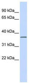 Leucine Rich Repeat Containing 25 antibody, TA340399, Origene, Western Blot image 