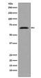Cell Division Cycle 7 antibody, M01190, Boster Biological Technology, Western Blot image 