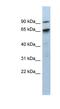 CBP80/20-dependent translation initiation factor antibody, NBP1-57319, Novus Biologicals, Western Blot image 