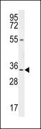 Leucine Rich Repeat Containing 18 antibody, 55-245, ProSci, Western Blot image 