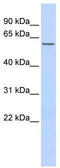 Zinc Finger Protein 672 antibody, TA333661, Origene, Western Blot image 