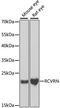 Recoverin antibody, A6404, ABclonal Technology, Western Blot image 