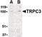 Transient Receptor Potential Cation Channel Subfamily C Member 3 antibody, PA5-20255, Invitrogen Antibodies, Western Blot image 