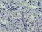 Solute Carrier Family 5 Member 1 antibody, NBP2-27565, Novus Biologicals, Immunohistochemistry paraffin image 