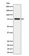 BRCA1 Associated ATM Activator 1 antibody, M06265, Boster Biological Technology, Western Blot image 
