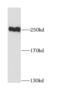 Myosin-10 antibody, FNab05471, FineTest, Western Blot image 