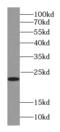RAB18, Member RAS Oncogene Family antibody, FNab06999, FineTest, Western Blot image 