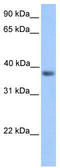Neuronal Differentiation 6 antibody, TA330530, Origene, Western Blot image 