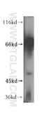 RIO Kinase 1 antibody, 17222-1-AP, Proteintech Group, Western Blot image 