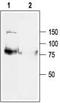 Potassium voltage-gated channel subfamily KQT member 1 antibody, TA328660, Origene, Western Blot image 
